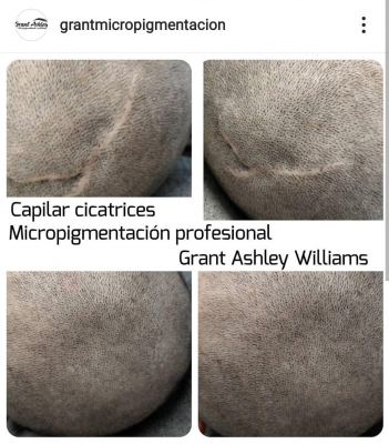 Foto Grant Ashley